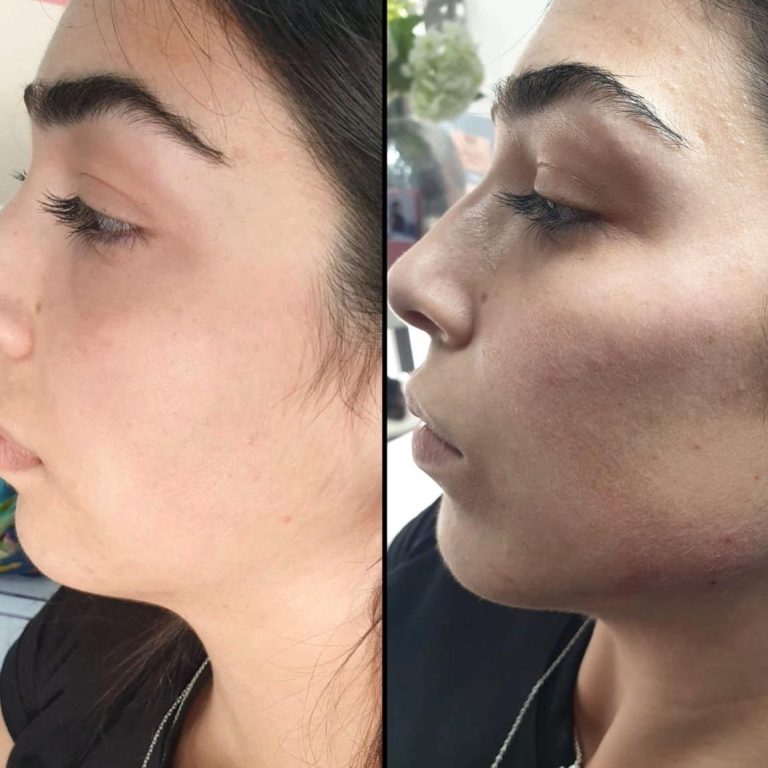 תמונה של WhatsApp‏ 2025-03-05 בשעה 10.49